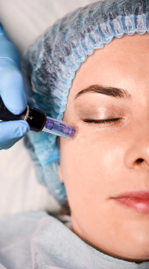 Solution d’acide hyaluronique pour soins de mésothérapie