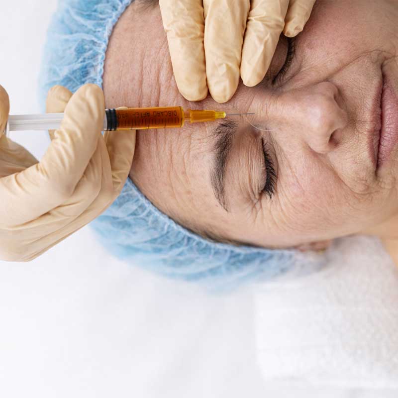comblement dermique fillers acide hyaluronique certifié CE