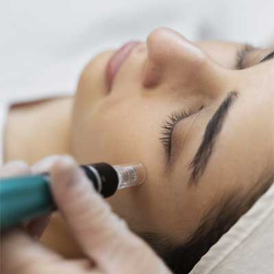 Séance de mésothérapie du visage pour hydrater et raffermir la peau